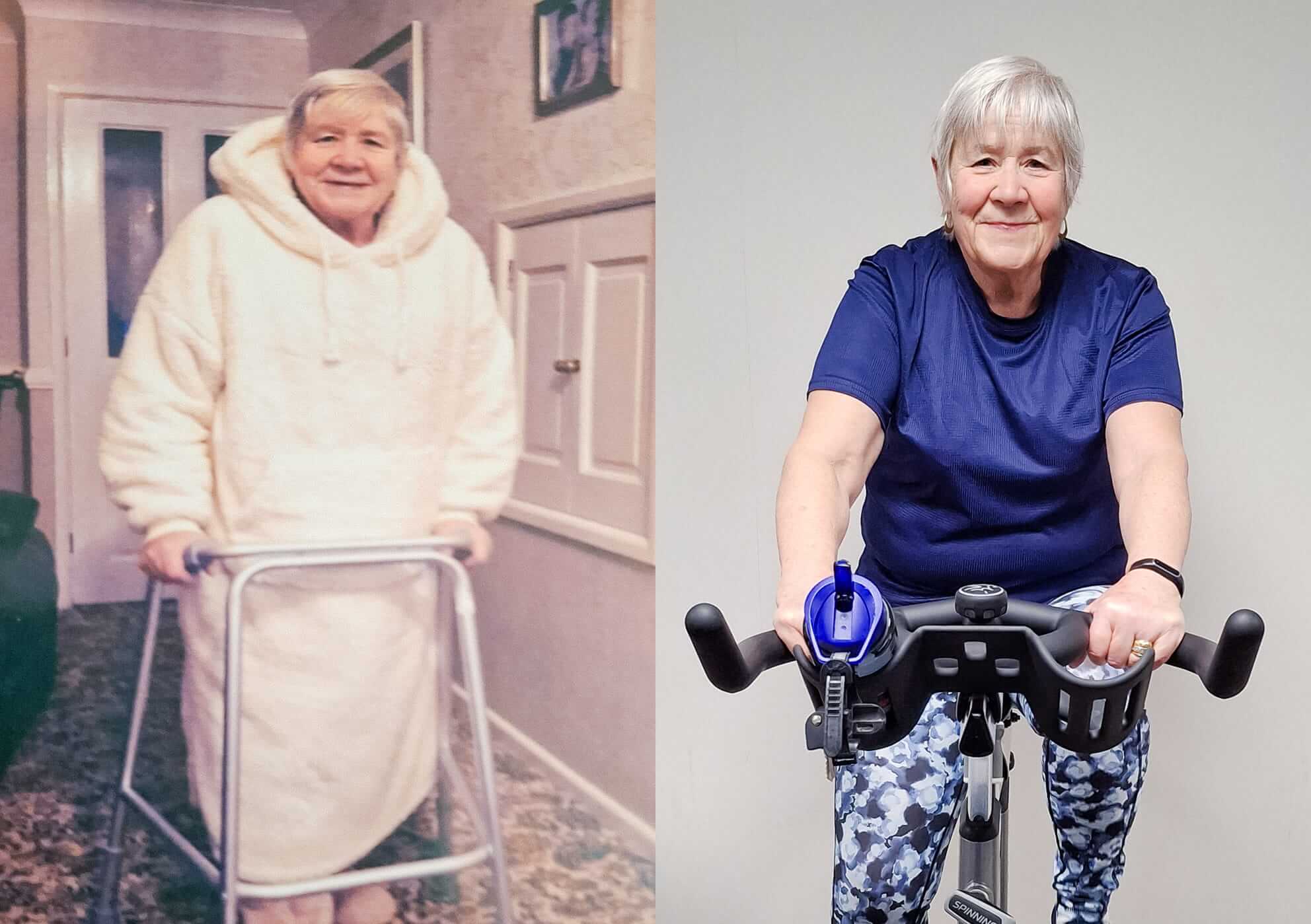 brenda vickers before and after brenda's story